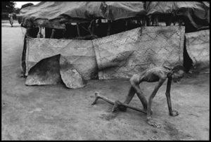 05. Starvation in the Sudan - Most Disturbing Pictures